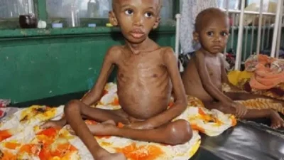 African countries risk running out of ‘wonder’ food soon due to aid cuts – Save the Children