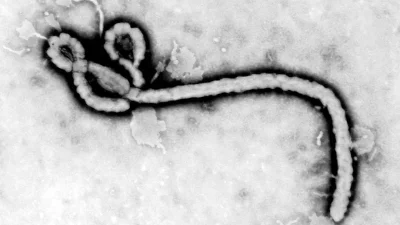 Ebola: NCDC intensifies surveillance amidst outbreak in Congo, Uganda