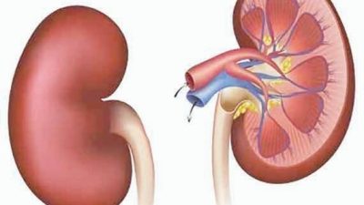 When the body speaks too late: A call for women’s kidney and NCD awareness