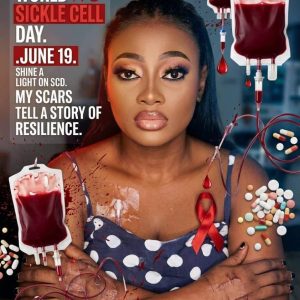 World Sickle Cell Day:  A warrior’s call to bridge treatment gaps, stigma