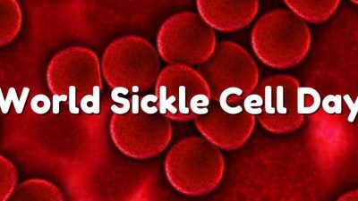 World Sickle Cell Day: Advancing Sustainable Care Through Community, Policy, and Innovation